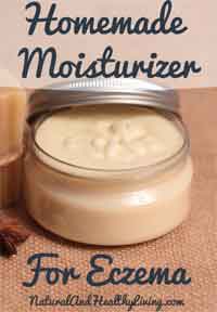 Homemade Eczema Cream