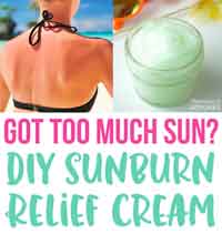 DIY Natural Sunburn Relief Cream