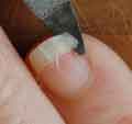 How to Mend a Broken Fingernail